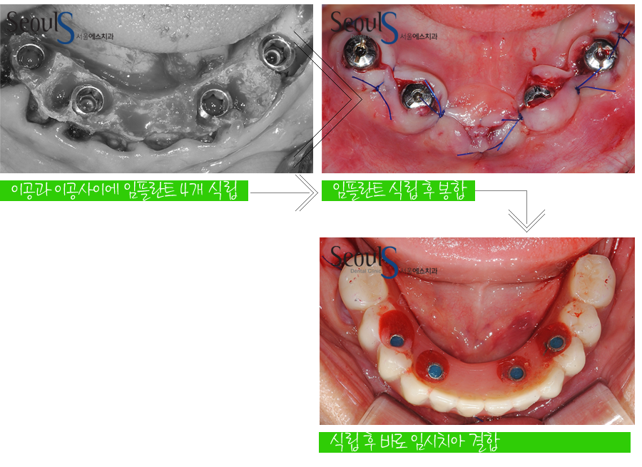 impmechiak20160614 (3)