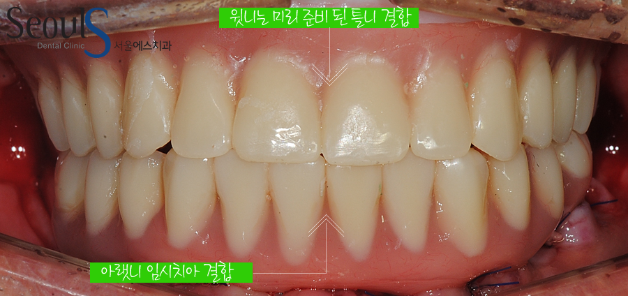 impmechiak20160614 (4)