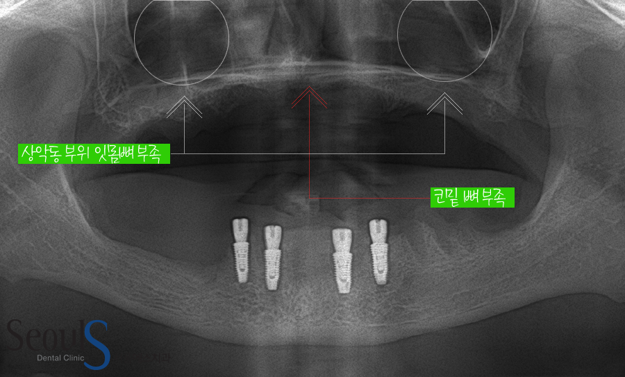 impmechiak20160614 (5)