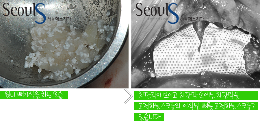 impmechiak20160614 (7)