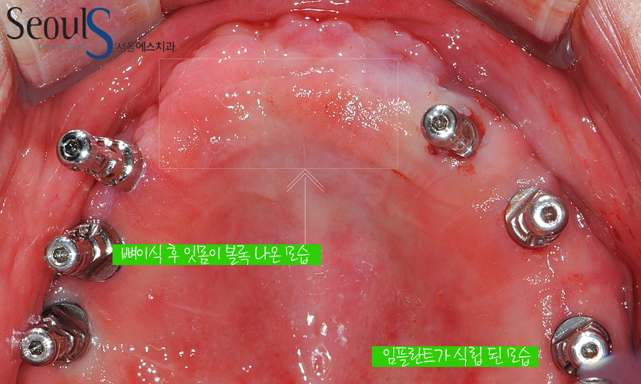 impmechiak20160614 (9)