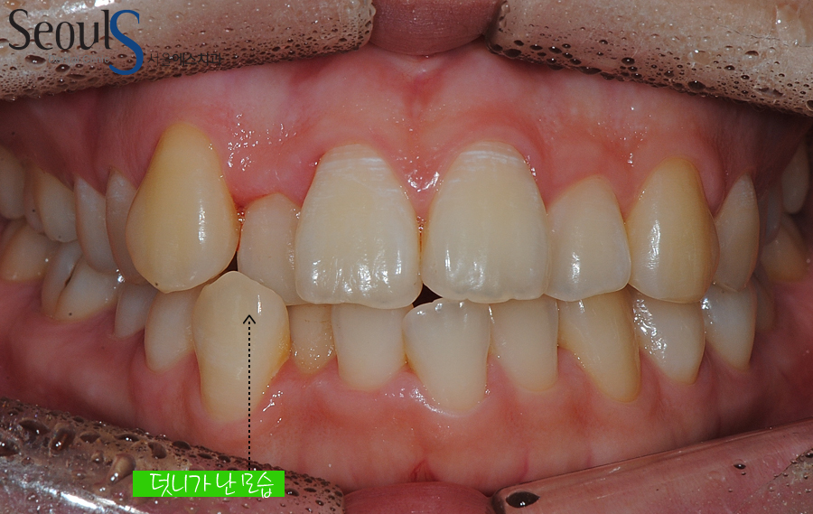 orth_20160615balcji (1)