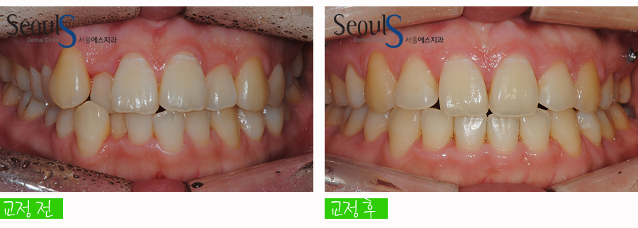 orth_20160615balcji (10)