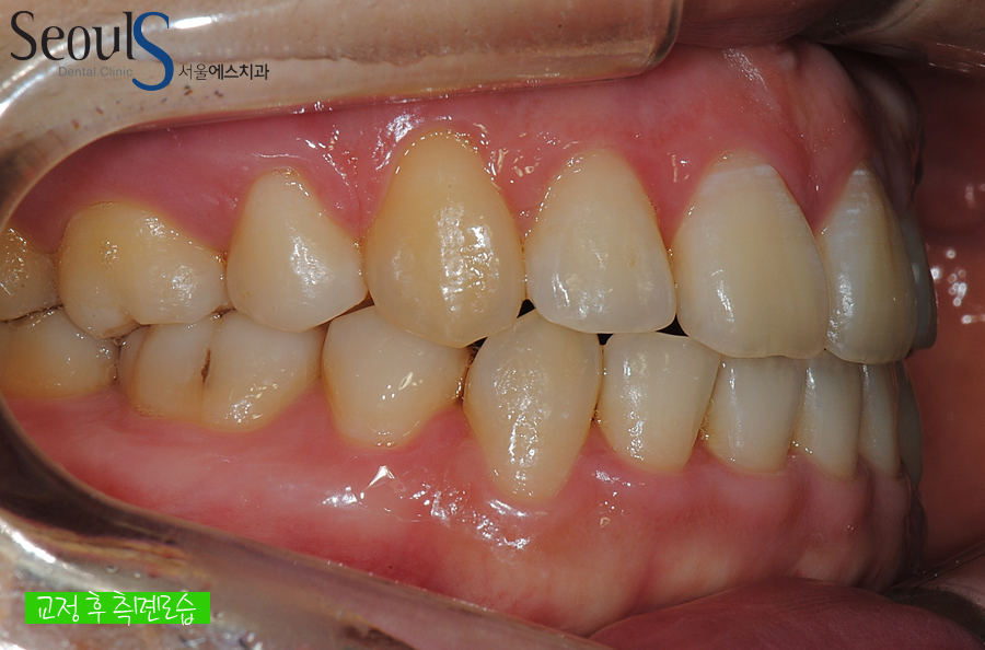 orth_20160615balcji (11)