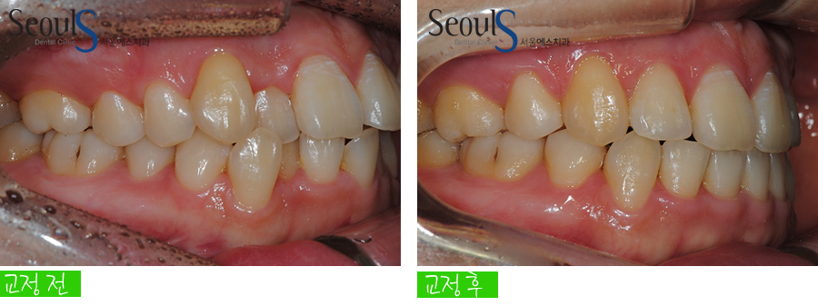 orth_20160615balcji (12)