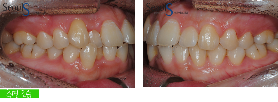 orth_20160615balcji (2)