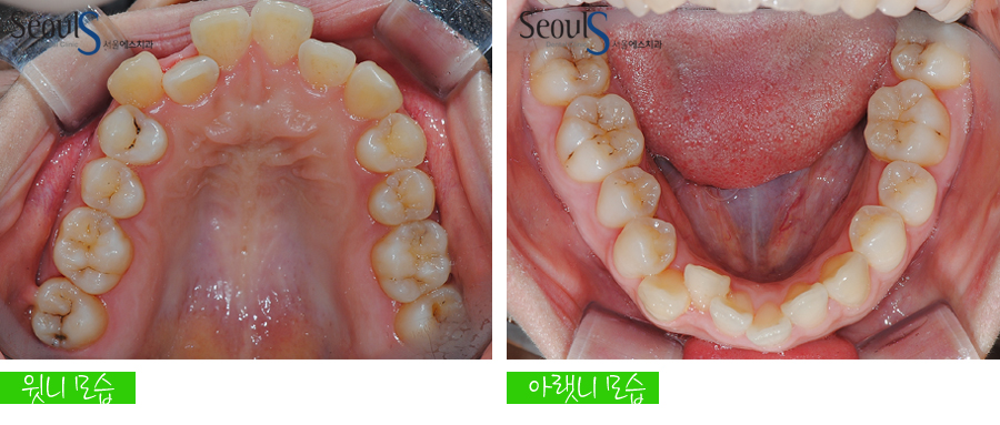 orth_20160615balcji (3)