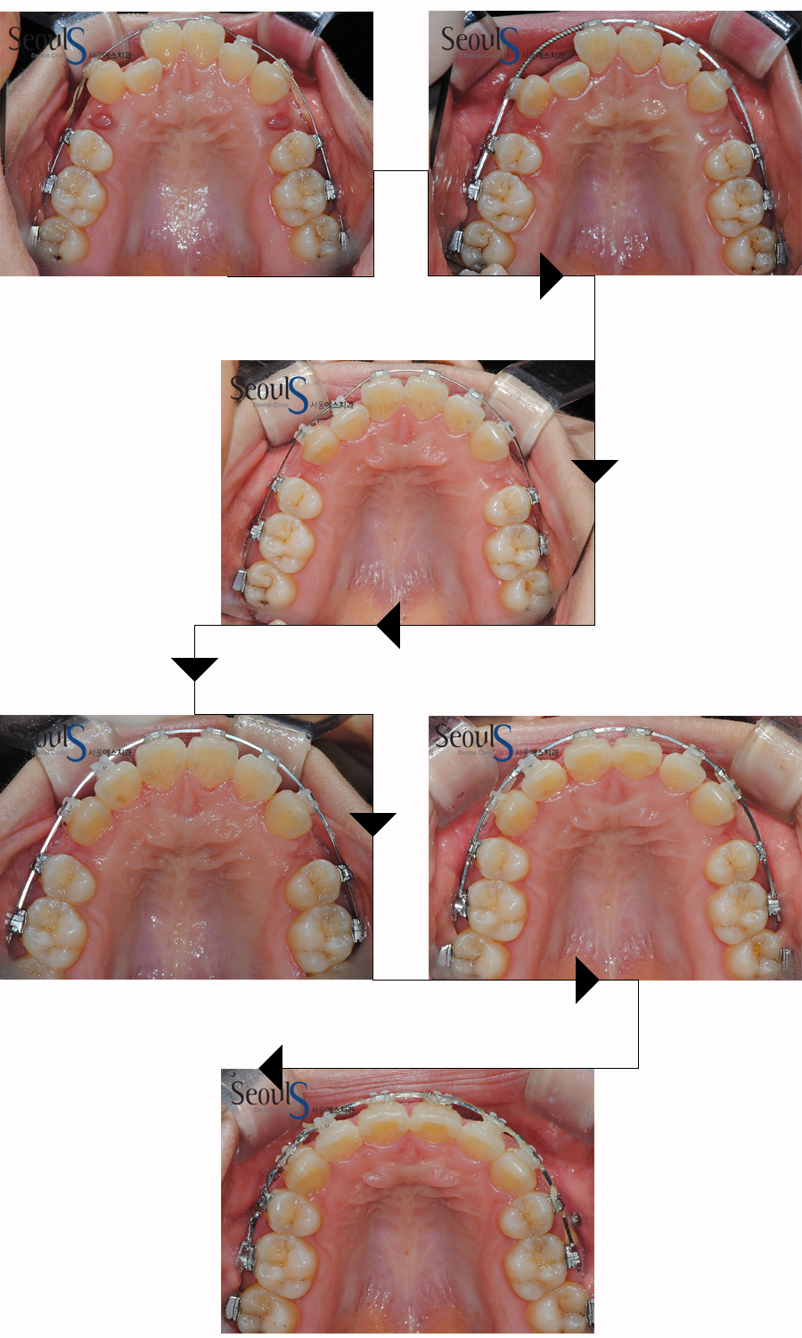 orth_20160615balcji (4)