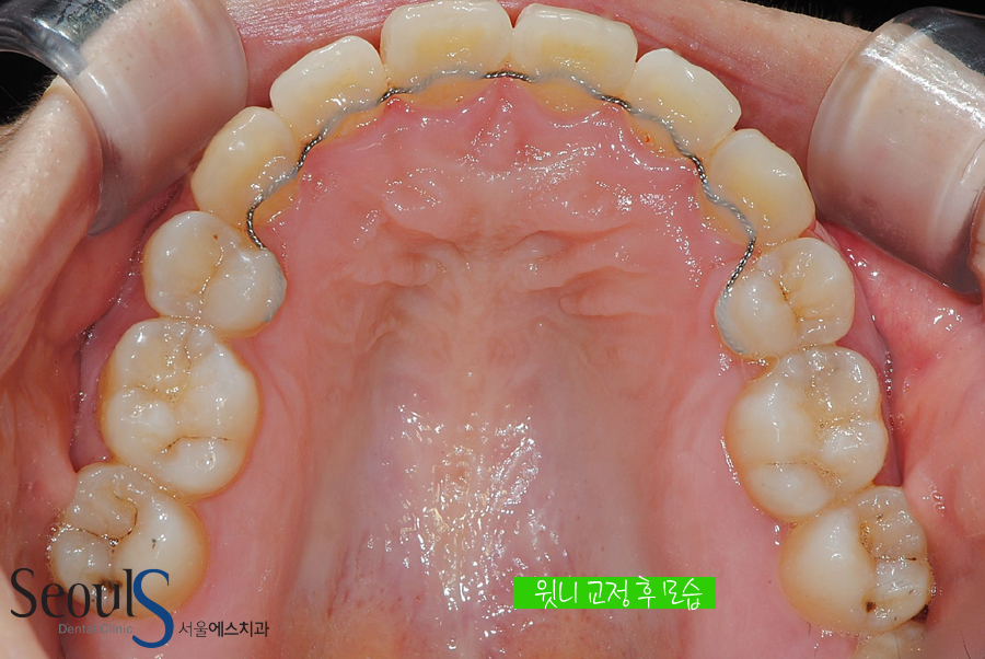 orth_20160615balcji (5)