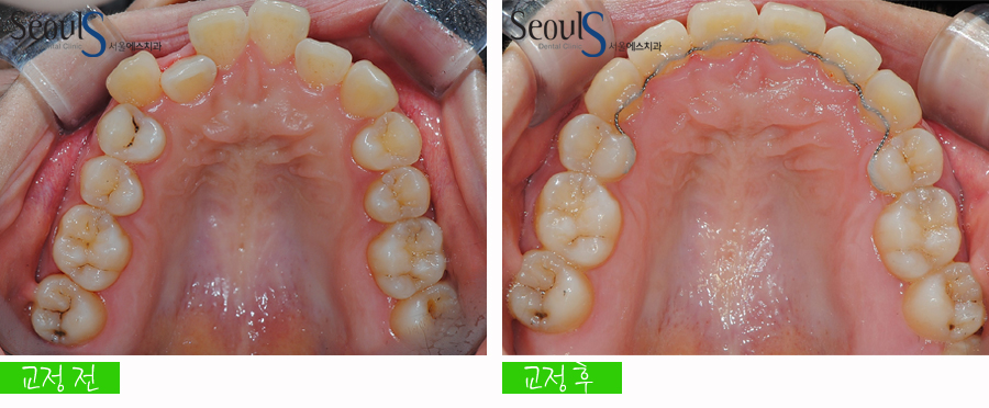 orth_20160615balcji (6)