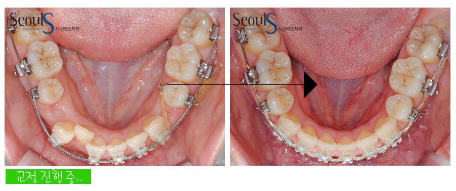 orth_20160615balcji (7)