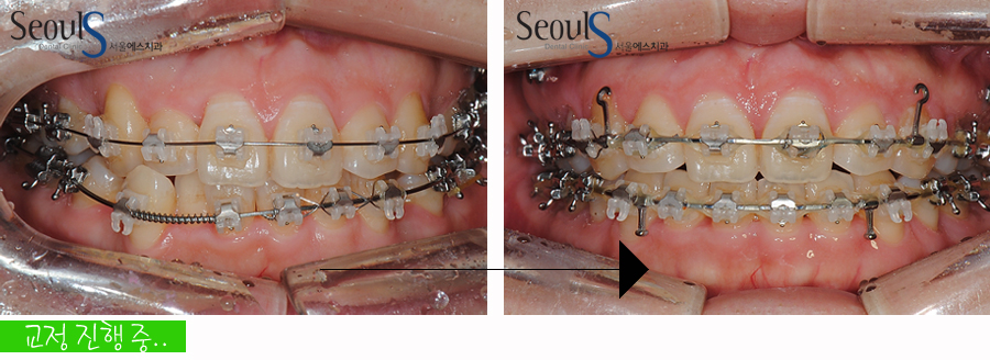 orth_20160615balcji (8)