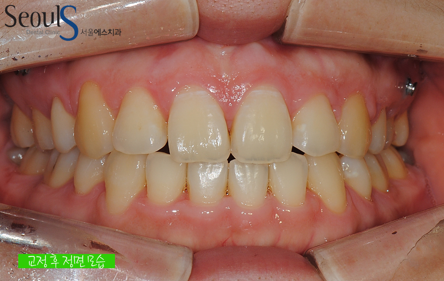 orth_20160615balcji (9)