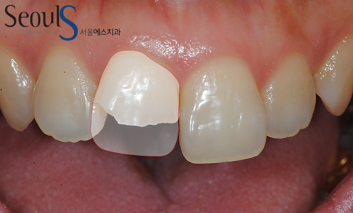 20160830-kimjinsu (3)