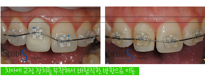 20160830-kimjinsu (6)