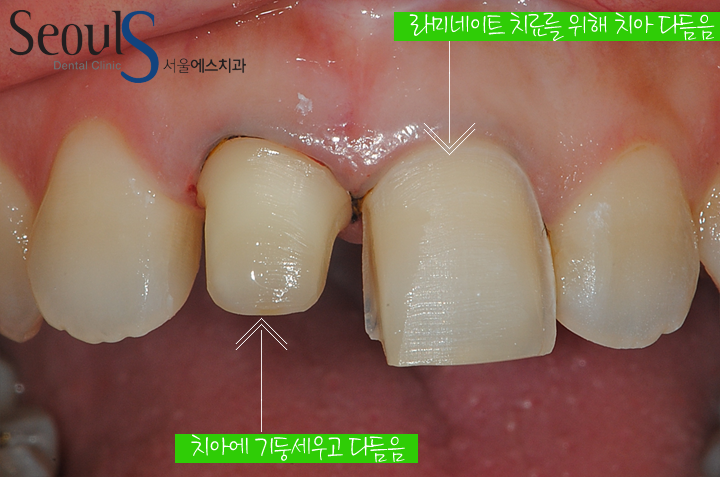 20160830-kimjinsu (7)