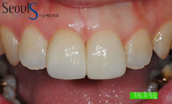 20160830-kimjinsu (8)