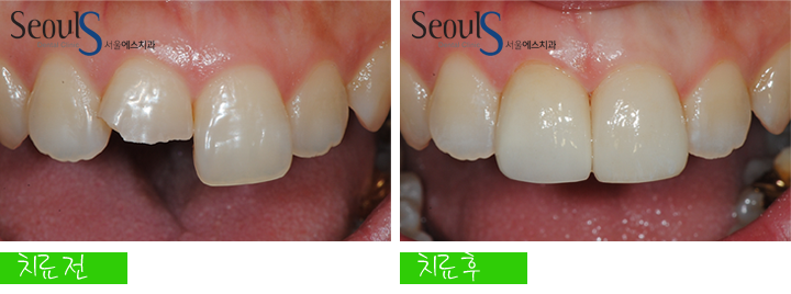 20160830-kimjinsu (9)