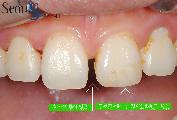 20160830-kimsoyhang (1)