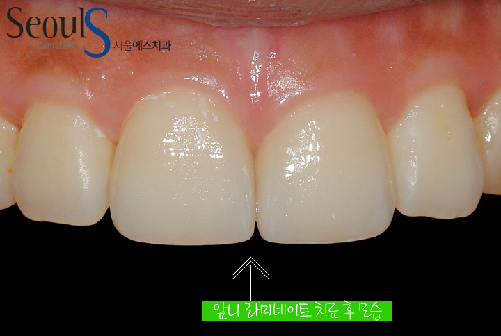 20160830-kimsoyhang (3)