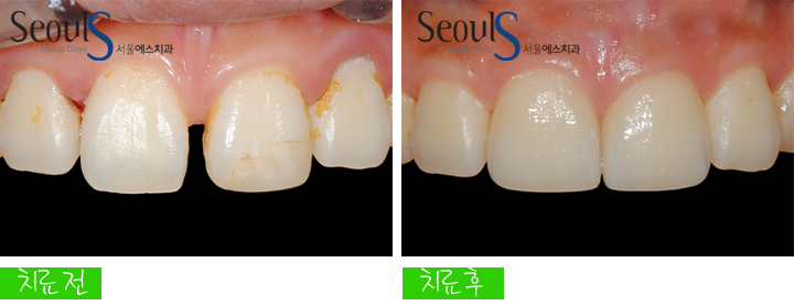 20160830-kimsoyhang (4)