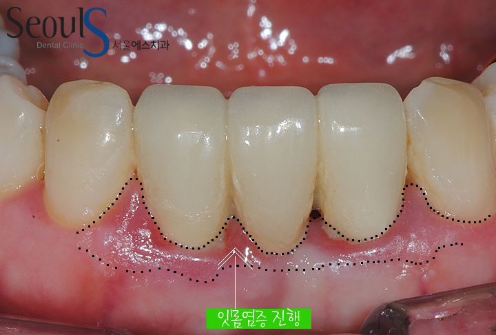 20160830-munmijin (1)