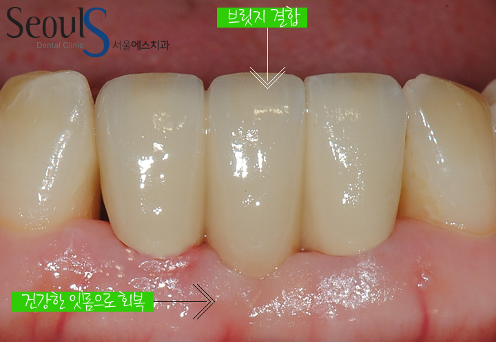 20160830-munmijin (10)