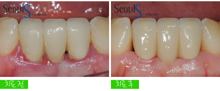 20160830-munmijin (11)