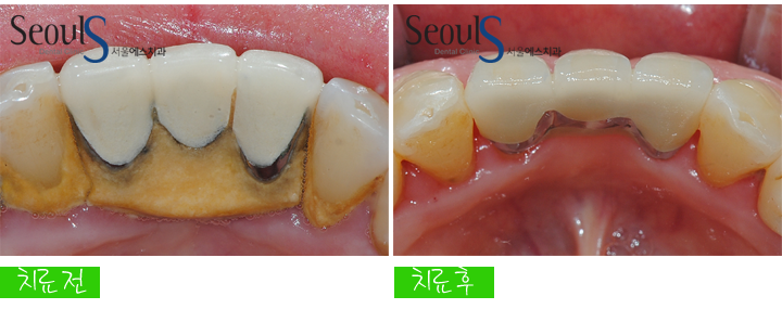 20160830-munmijin (12)