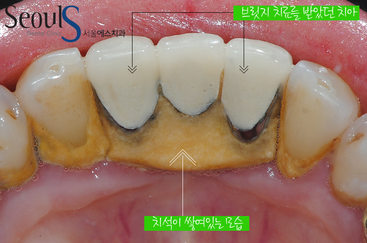 20160830-munmijin (2)