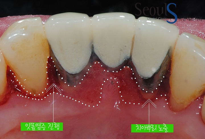 20160830-munmijin (3)