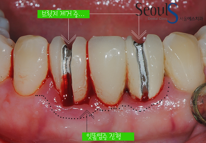 20160830-munmijin (4)