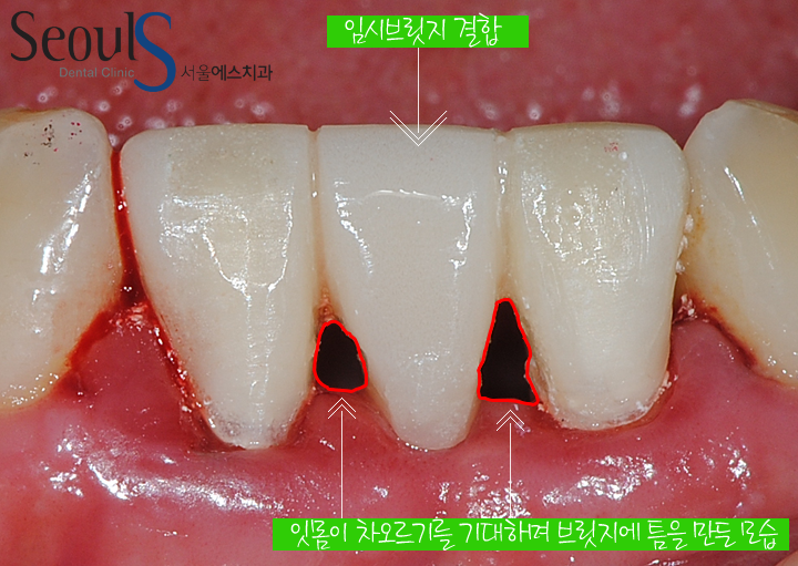 20160830-munmijin (6)