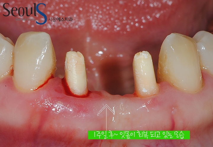 20160830-munmijin (7)