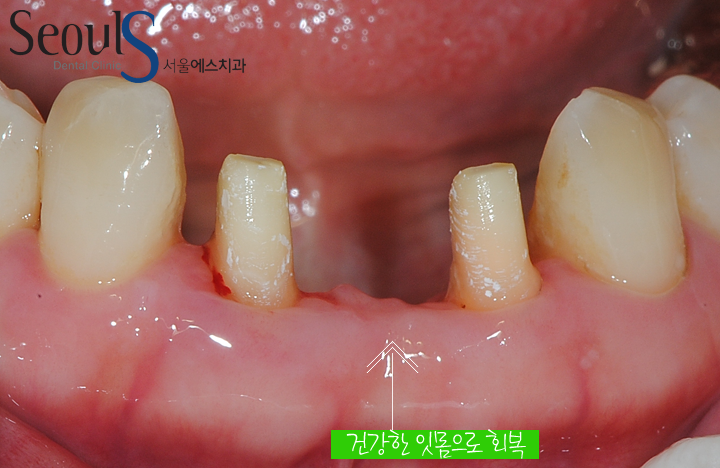 20160830-munmijin (8)