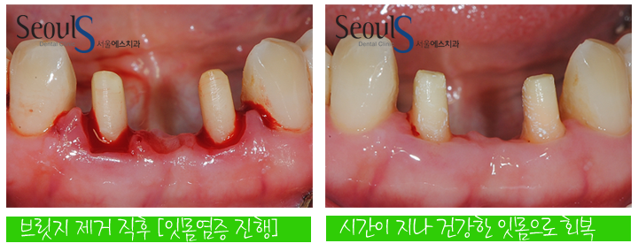 20160830-munmijin (9)