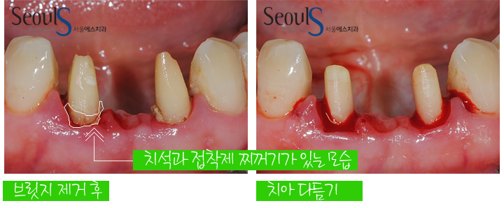 20160830-munmijin-5-1