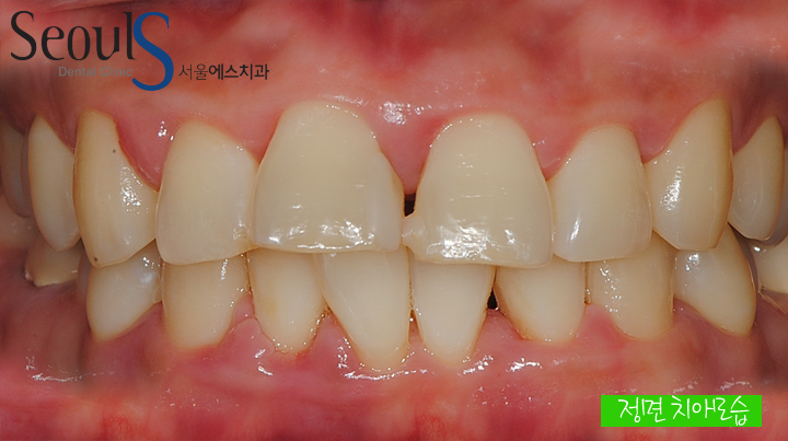 20160905hansongh (1)