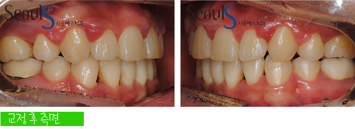 20160905hansongh (13)