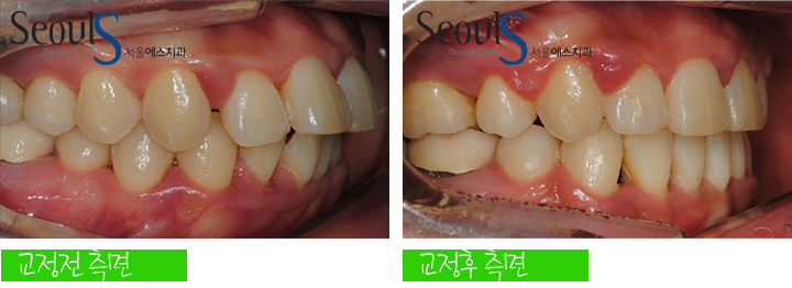 20160905hansongh (15)