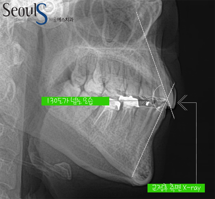 20160905hansongh-16-1