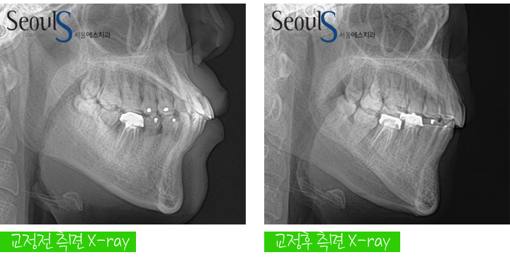 20160905hansongh (17)