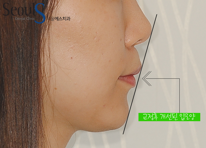 20160905hansongh-18-1