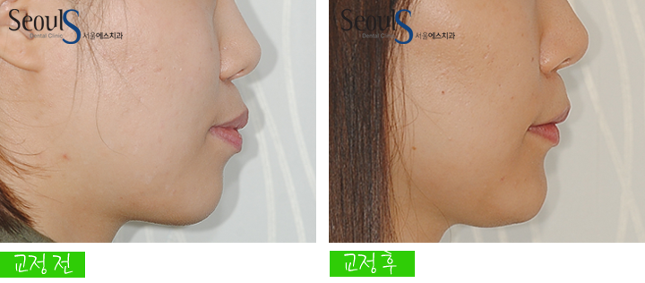 20160905hansongh (19)