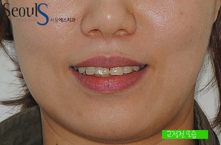 20160905hansongh (3)