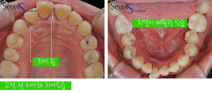 20160905hansongh (4)