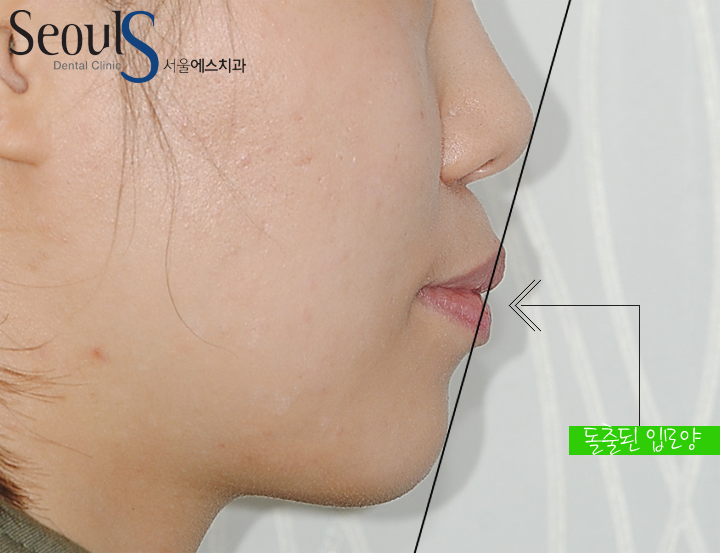 20160905hansongh-5-1