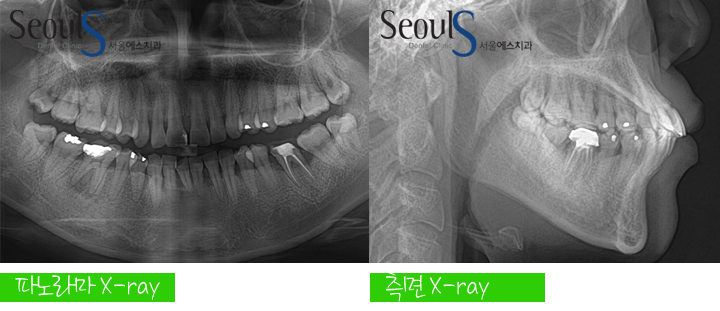 20160905hansongh (8)