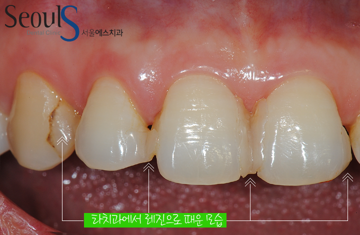 20160915-joeunsook-2