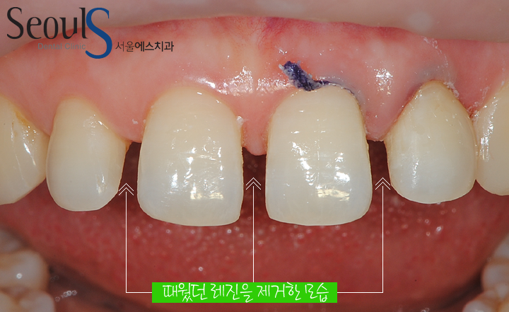 20160915-joeunsook-3